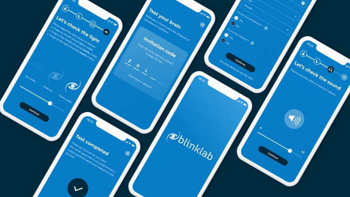 اتفاق مغربي–أسترالي لإطلاق برنامج وطني للكشف المبكر عن التوحد