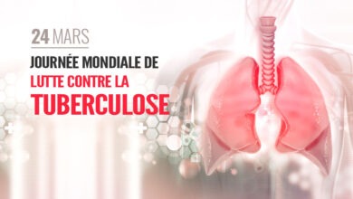 السل خارج الرئة يهيمن على الإصابات الجديدة في المغرب