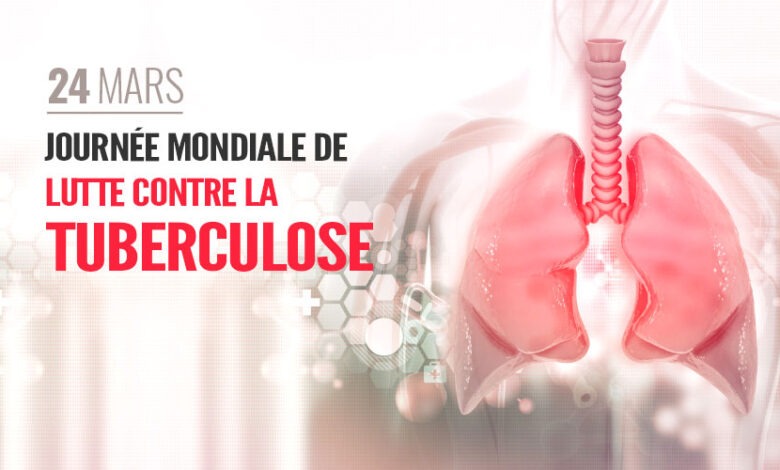 السل خارج الرئة يهيمن على الإصابات الجديدة في المغرب